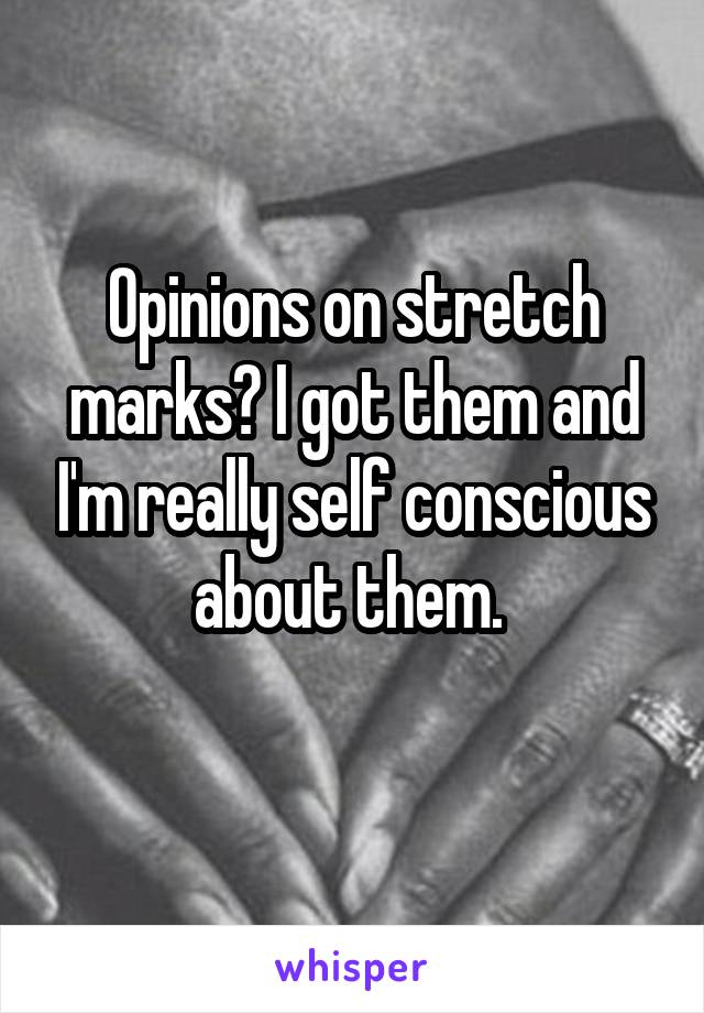 Opinions on stretch marks? I got them and I'm really self conscious about them. 
