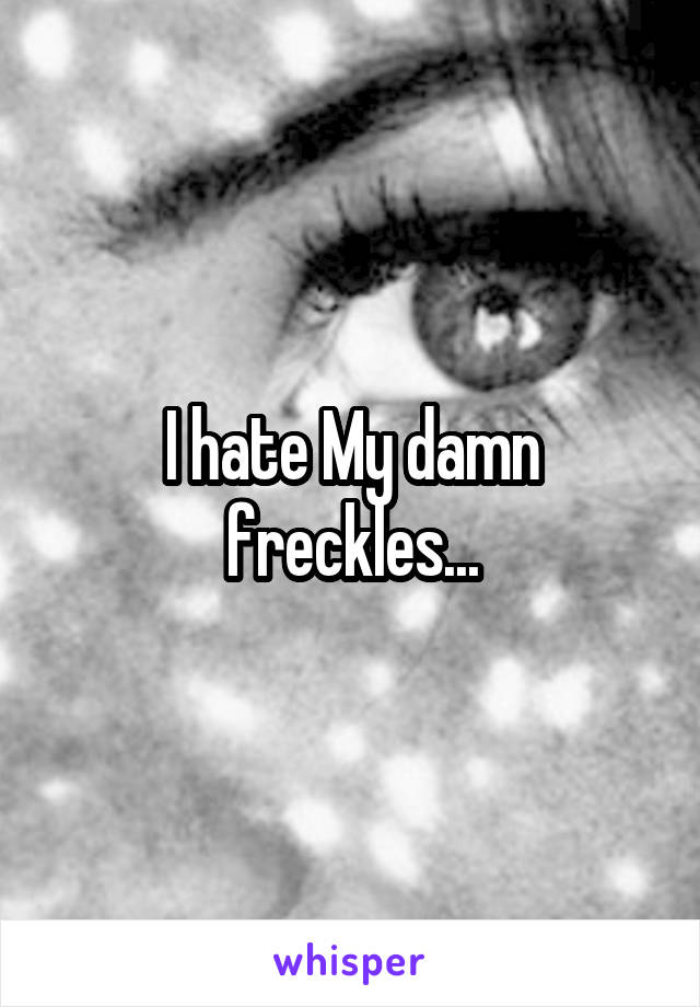 I hate My damn freckles...
