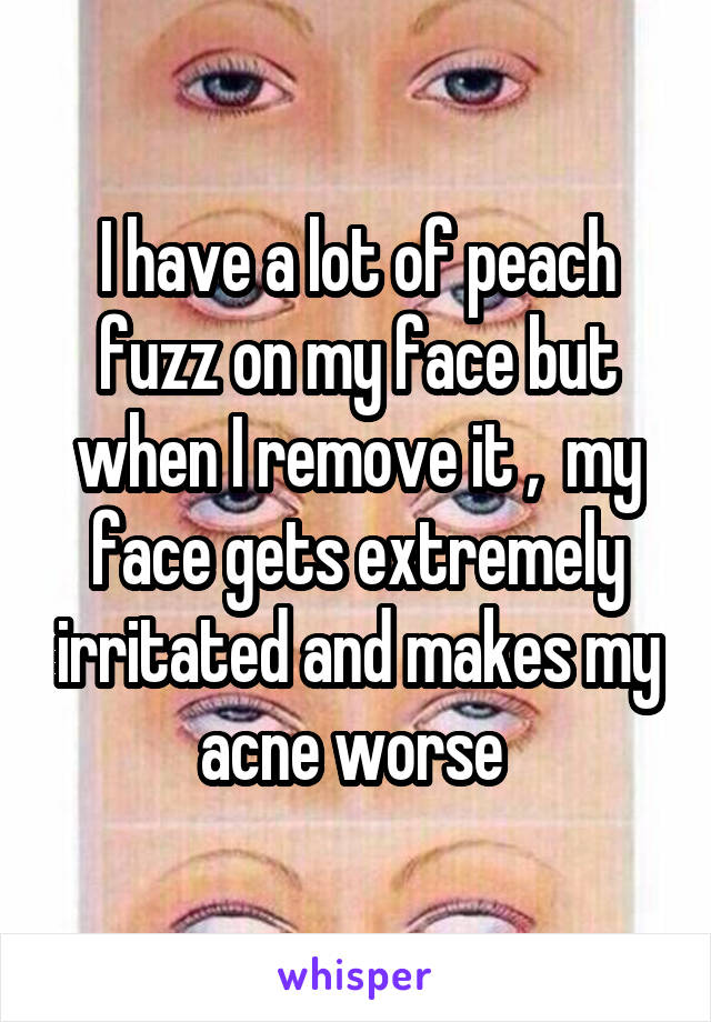 I have a lot of peach fuzz on my face but when I remove it ,  my face gets extremely irritated and makes my acne worse 