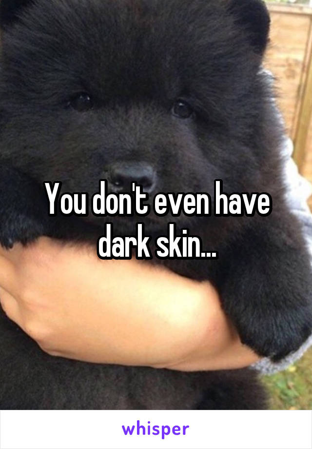 You don't even have dark skin...