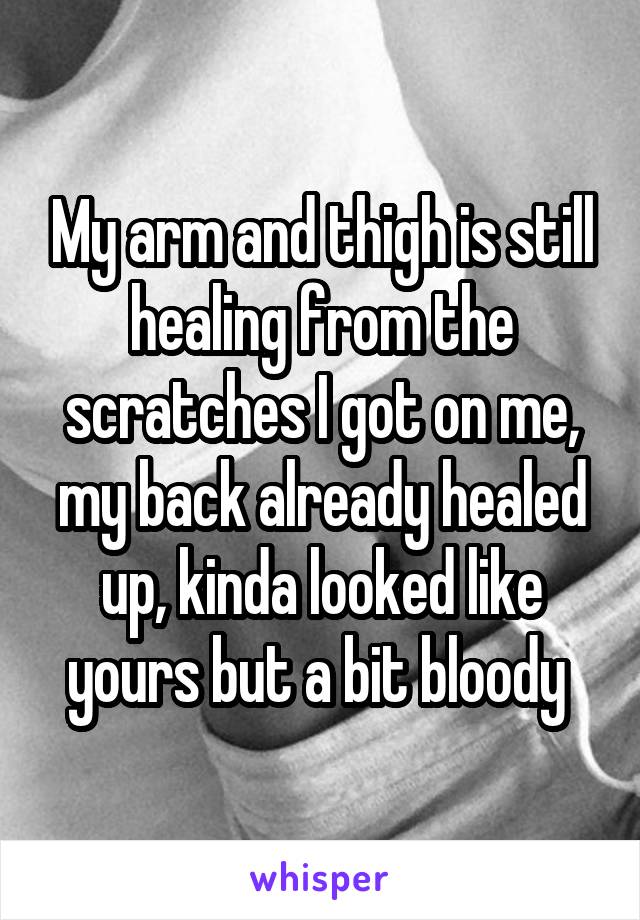 My arm and thigh is still healing from the scratches I got on me, my back already healed up, kinda looked like yours but a bit bloody 