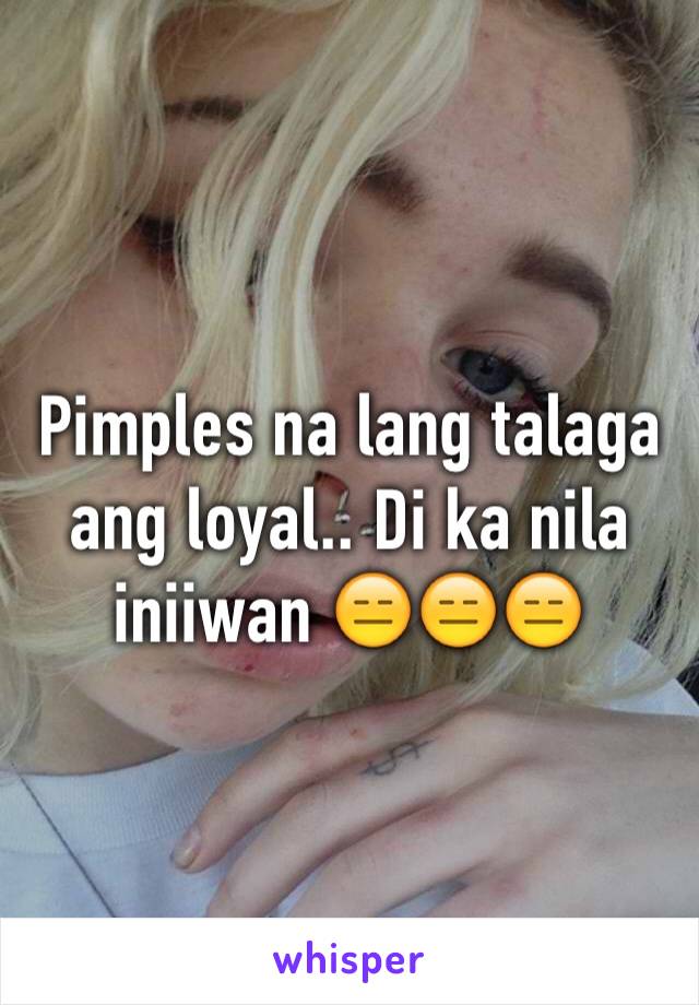 Pimples na lang talaga ang loyal.. Di ka nila iniiwan 😑😑😑