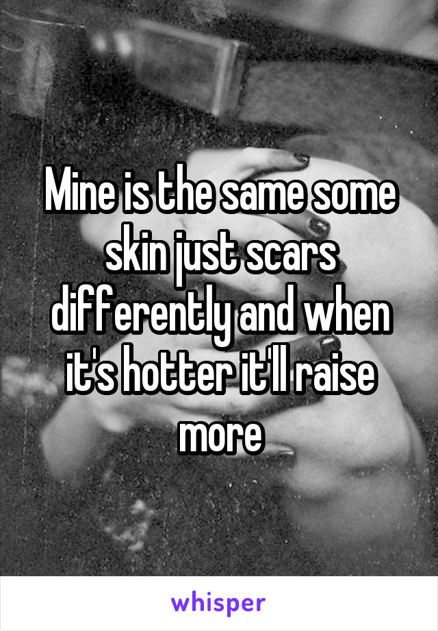 Mine is the same some skin just scars differently and when it's hotter it'll raise more