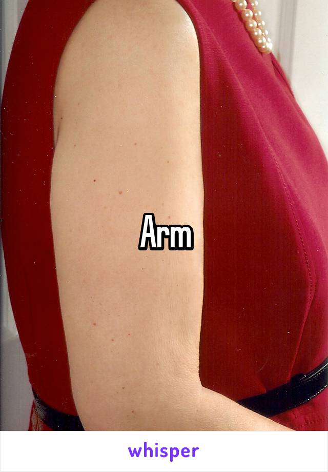 Arm