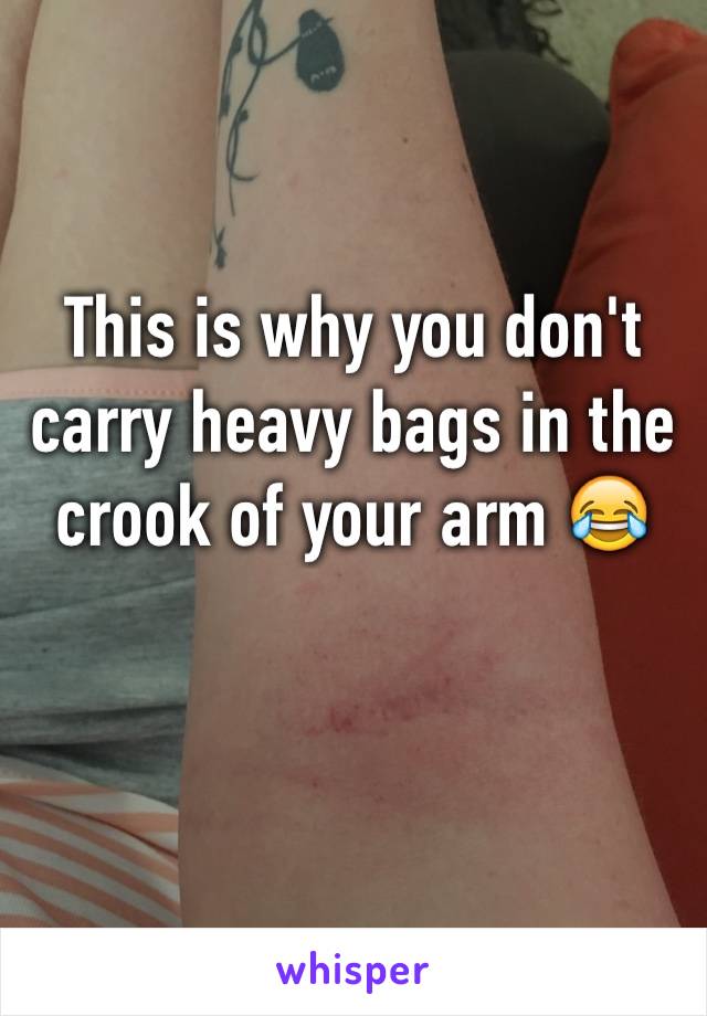 This is why you don't carry heavy bags in the crook of your arm 😂 