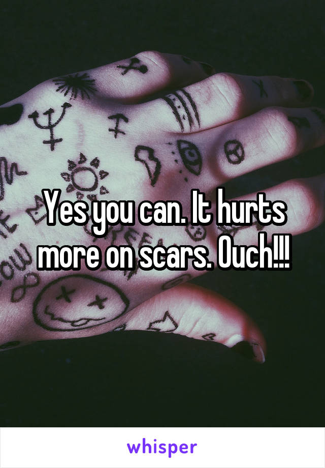 Yes you can. It hurts more on scars. Ouch!!!