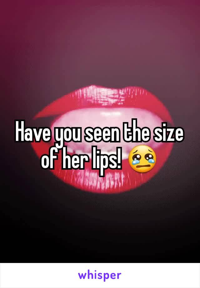 Have you seen the size of her lips! 😢