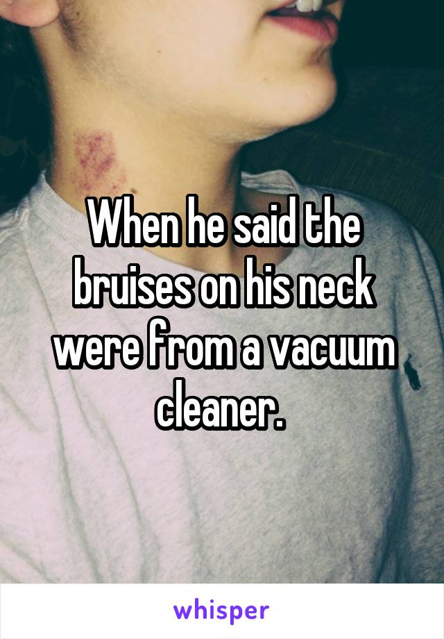 When he said the bruises on his neck were from a vacuum cleaner. 