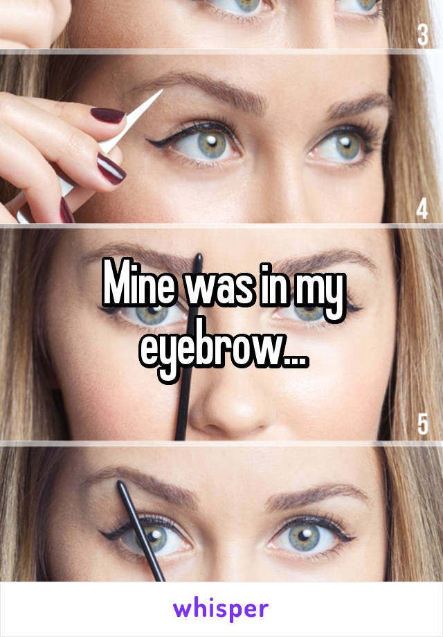 Mine was in my eyebrow...