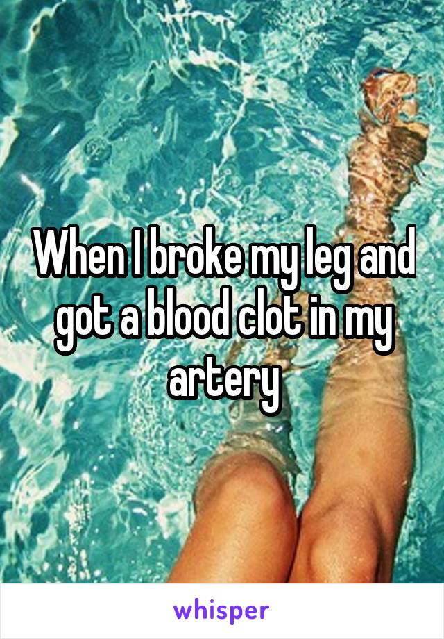 When I broke my leg and got a blood clot in my artery