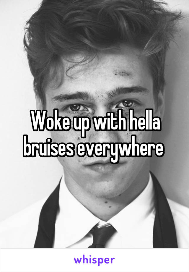 Woke up with hella bruises everywhere 