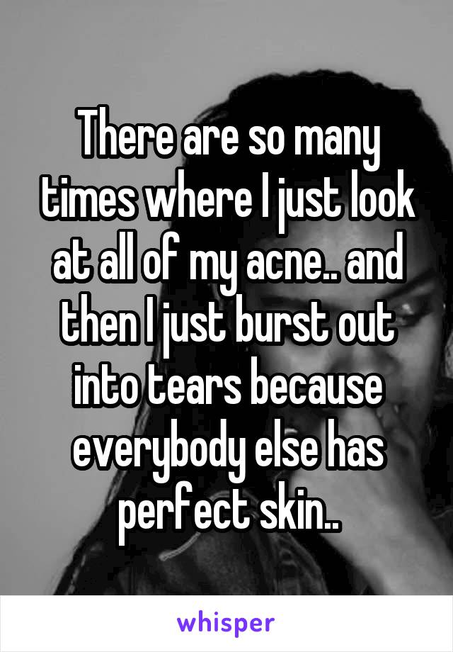 There are so many times where I just look at all of my acne.. and then I just burst out into tears because everybody else has perfect skin..