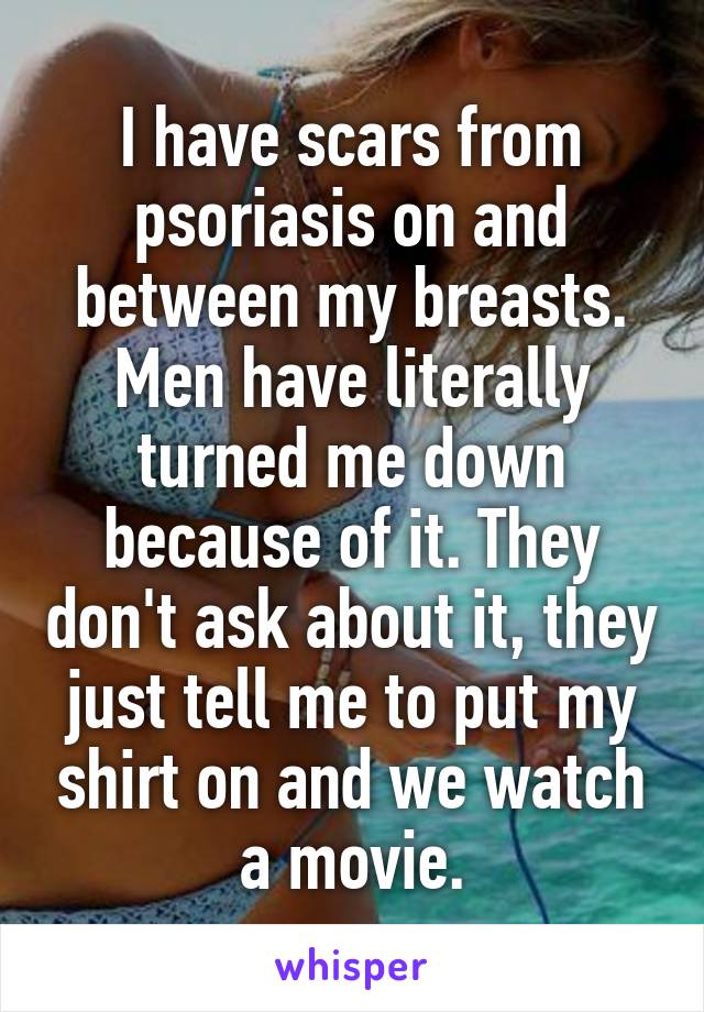 I have scars from psoriasis on and between my breasts. Men have literally turned me down because of it. They don't ask about it, they just tell me to put my shirt on and we watch a movie.