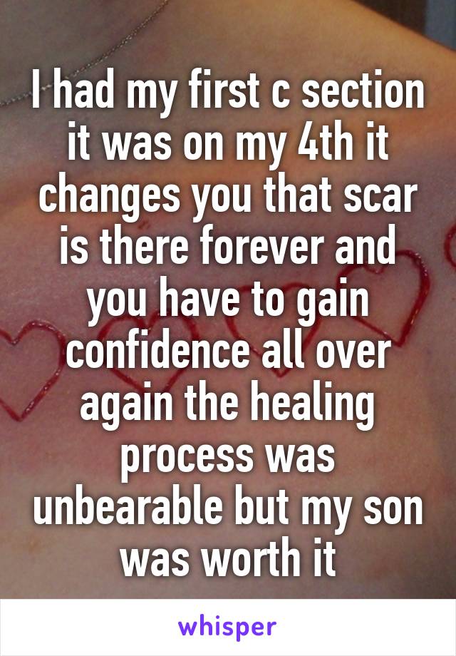 I had my first c section it was on my 4th it changes you that scar is there forever and you have to gain confidence all over again the healing process was unbearable but my son was worth it