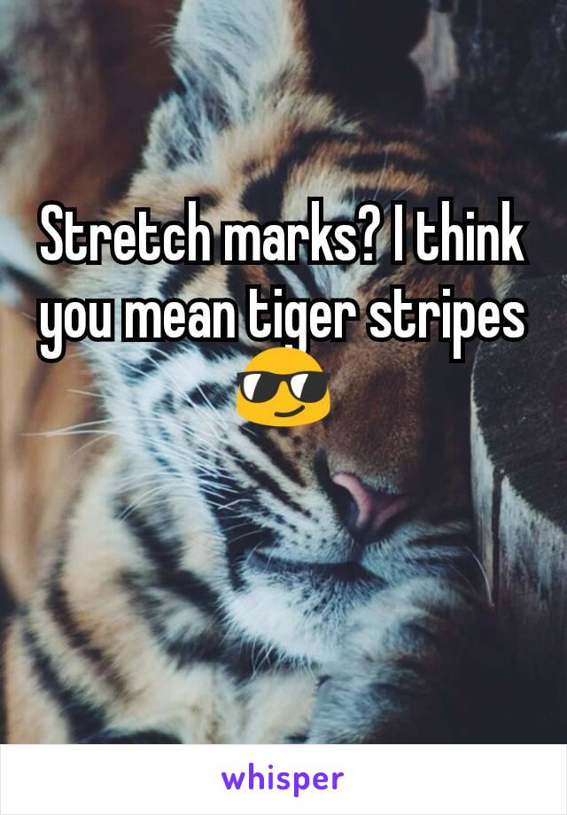 Stretch marks? I think you mean tiger stripes 😎
