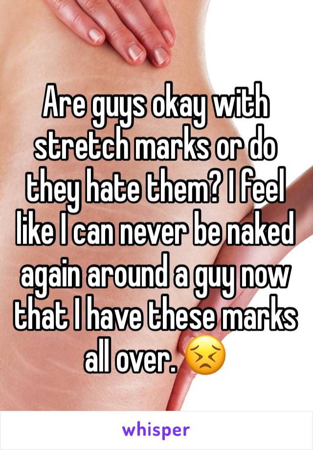 Are guys okay with stretch marks or do they hate them? I feel like I can never be naked again around a guy now that I have these marks all over. 😣