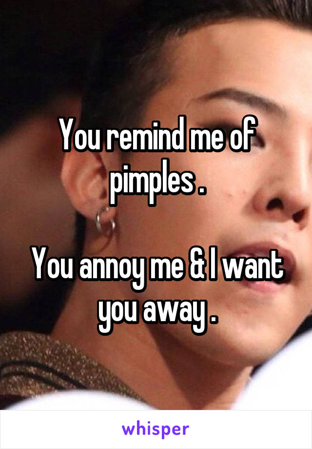 You remind me of pimples .

You annoy me & I want you away .