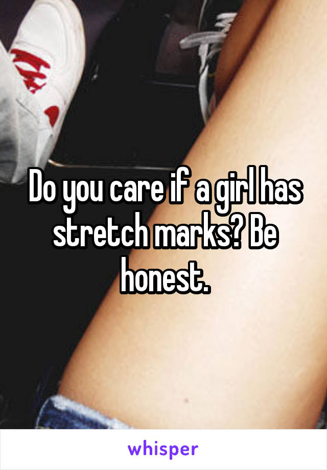 Do you care if a girl has stretch marks? Be honest.