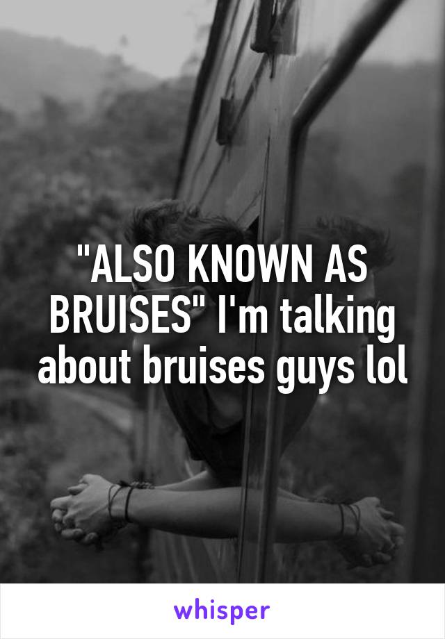 "ALSO KNOWN AS BRUISES" I'm talking about bruises guys lol