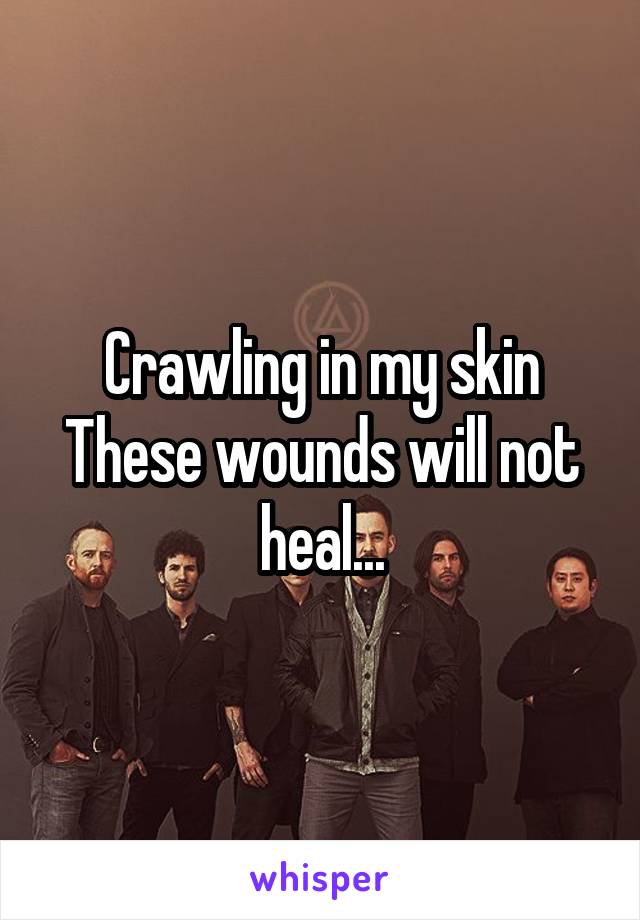 Crawling in my skin
These wounds will not heal...