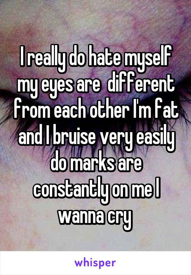 I really do hate myself my eyes are  different from each other I'm fat and I bruise very easily do marks are constantly on me I wanna cry 