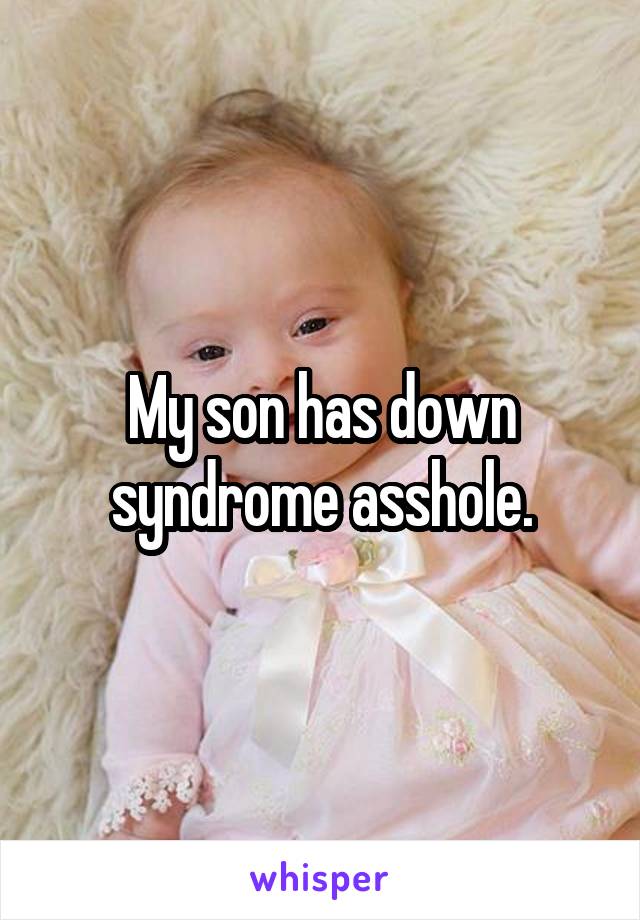 My son has down syndrome asshole.