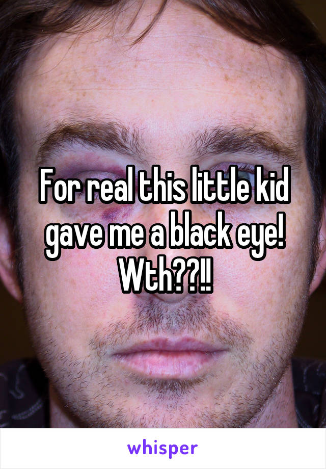 For real this little kid gave me a black eye! Wth??!!