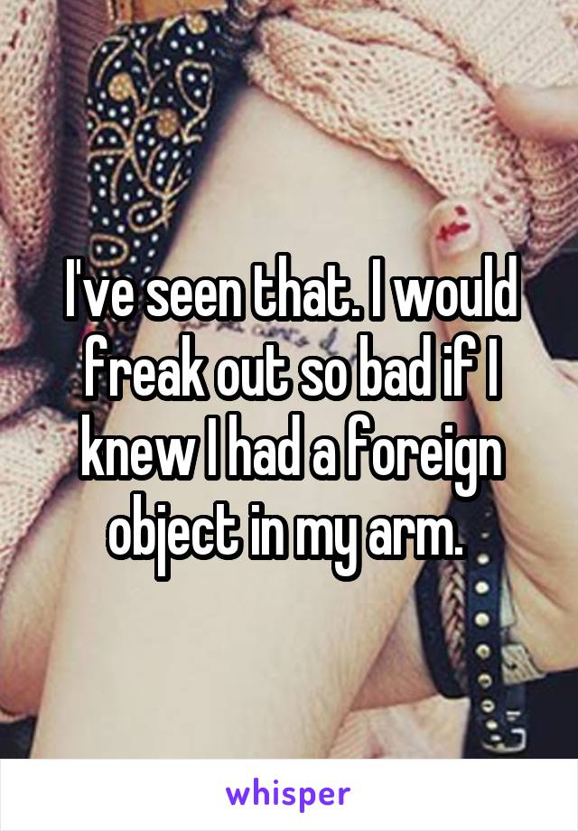 I've seen that. I would freak out so bad if I knew I had a foreign object in my arm. 