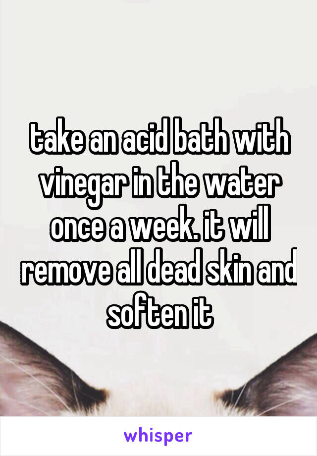 take an acid bath with vinegar in the water once a week. it will remove all dead skin and soften it
