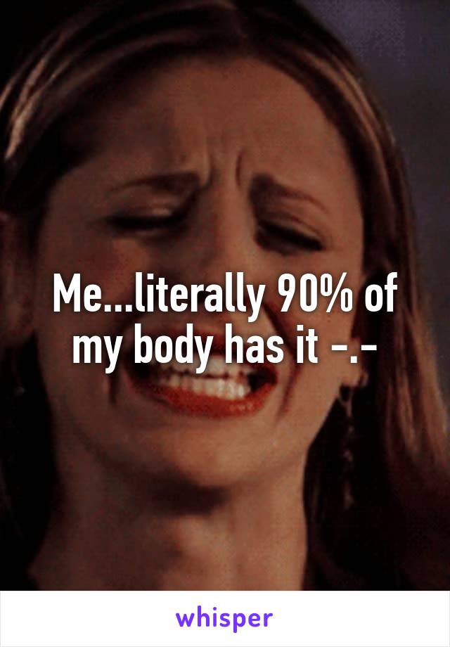 Me...literally 90% of my body has it -.-