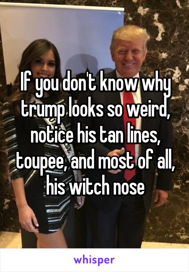 If you don't know why trump looks so weird, notice his tan lines, toupee, and most of all, his witch nose