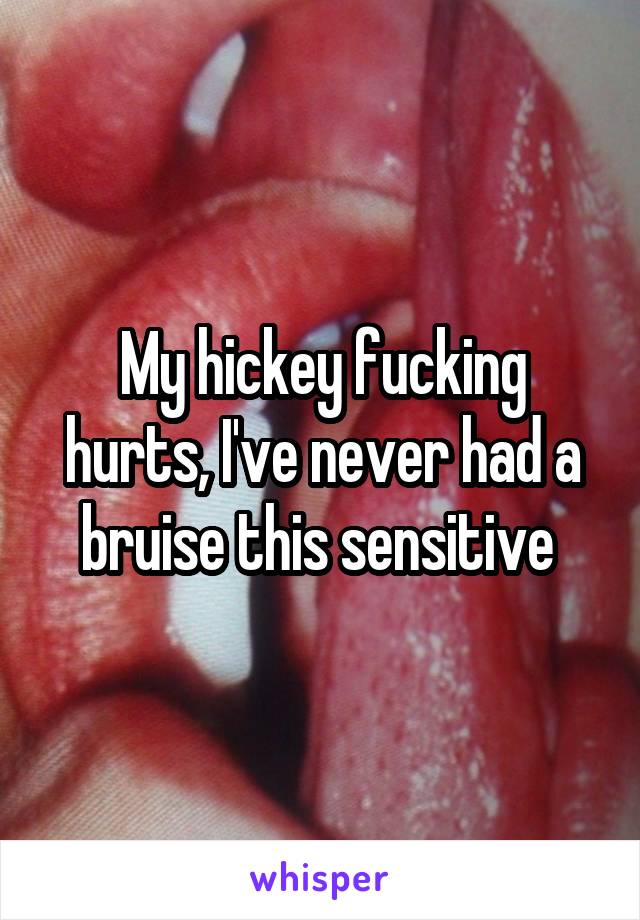 My hickey fucking hurts, I've never had a bruise this sensitive 