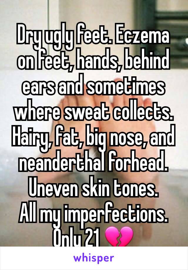 Dry ugly feet. Eczema on feet, hands, behind ears and sometimes where sweat collects. Hairy, fat, big nose, and neanderthal forhead. Uneven skin tones.
All my imperfections.
Only 21 💔