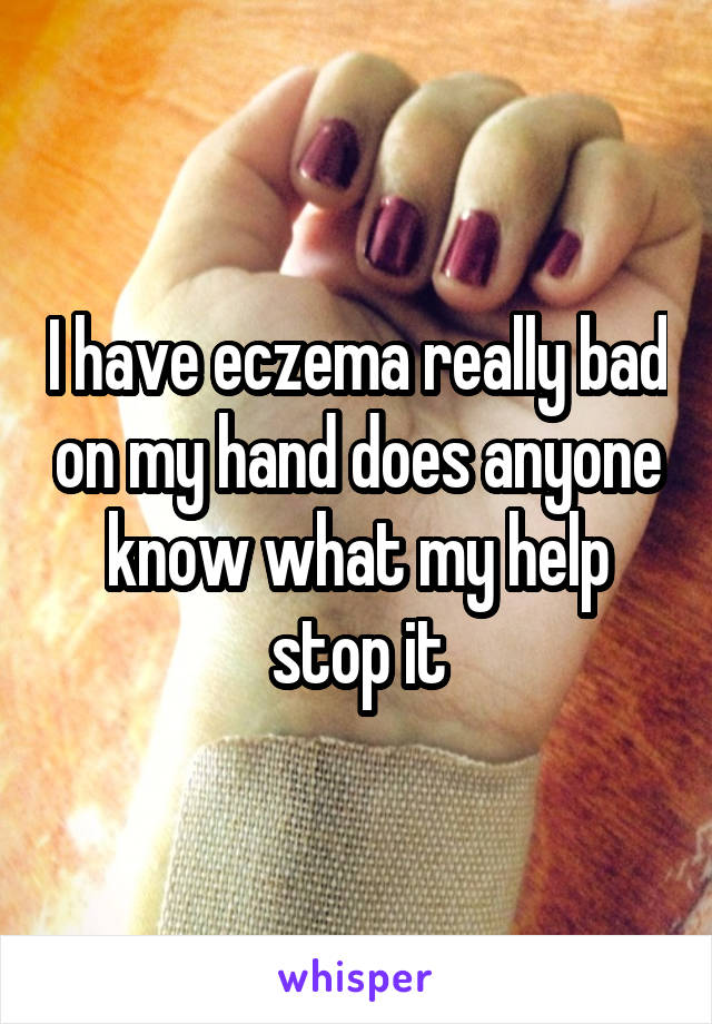 I have eczema really bad on my hand does anyone know what my help stop it