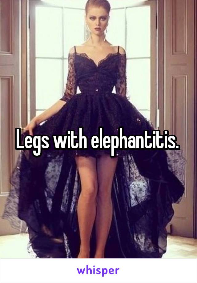 Legs with elephantitis. 