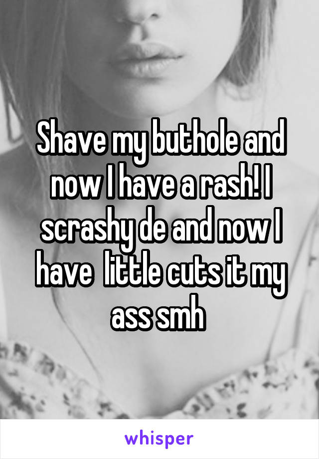 Shave my buthole and now I have a rash! I scrashy de and now I have  little cuts it my ass smh 