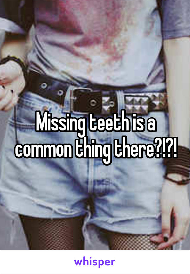Missing teeth is a common thing there?!?!