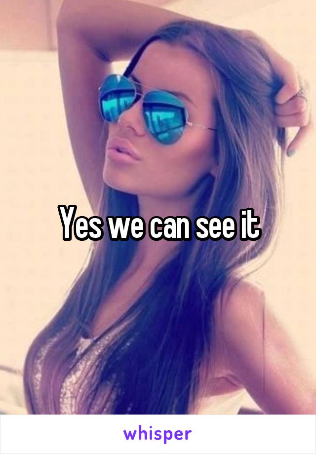 Yes we can see it