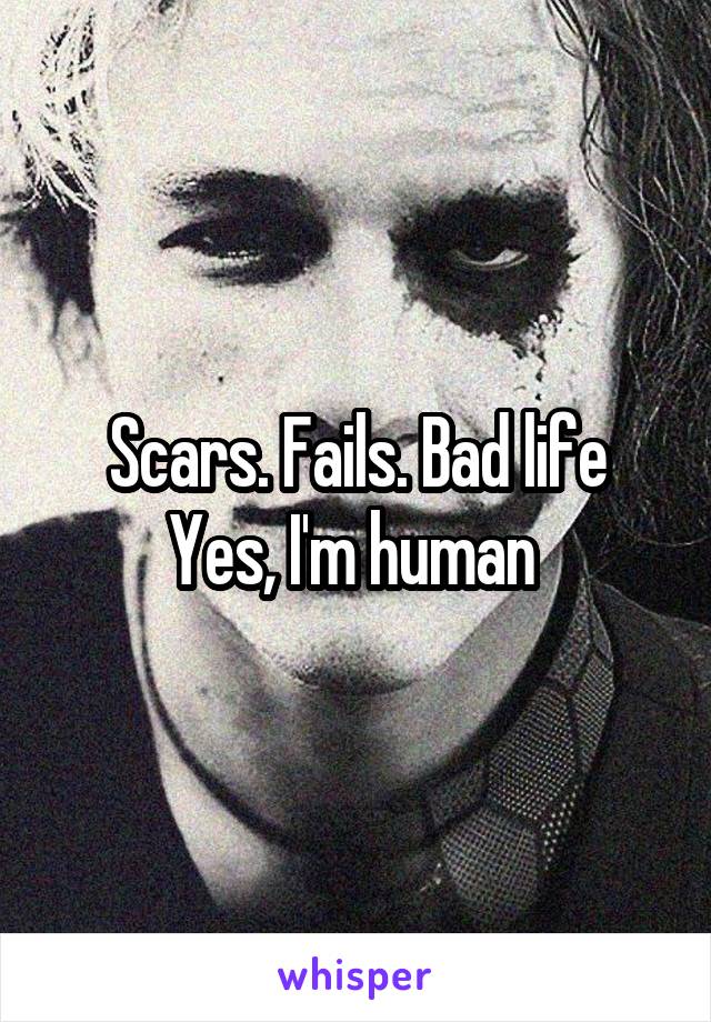 Scars. Fails. Bad life
Yes, I'm human 