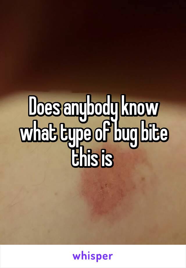 Does anybody know what type of bug bite this is 