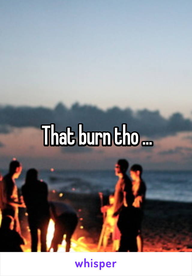 That burn tho ...
