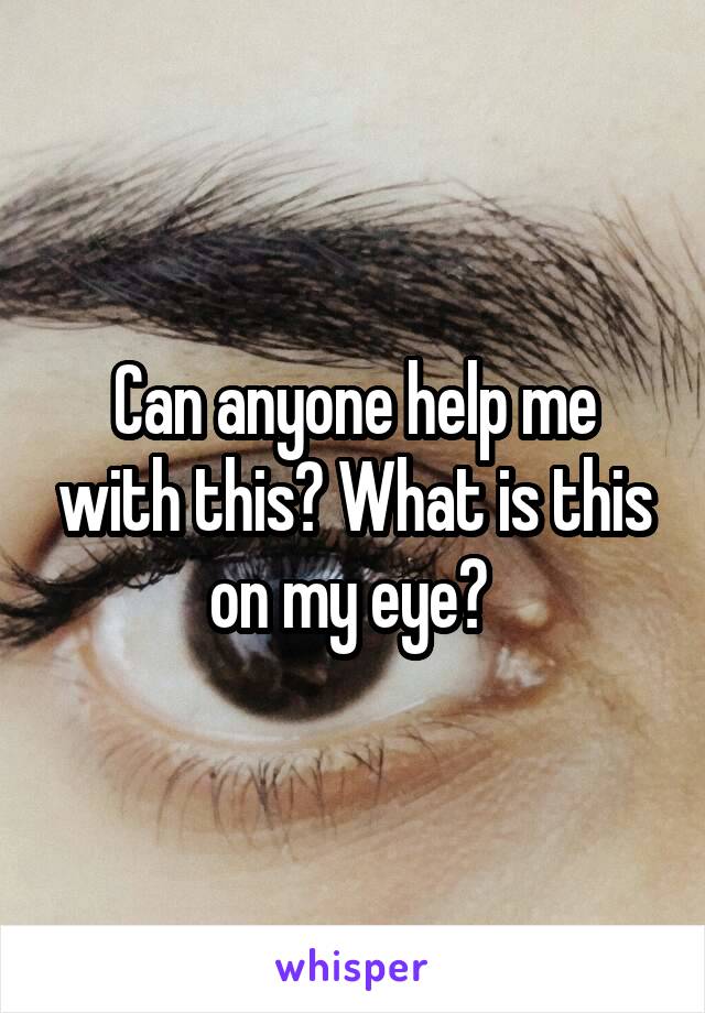 Can anyone help me with this? What is this on my eye? 