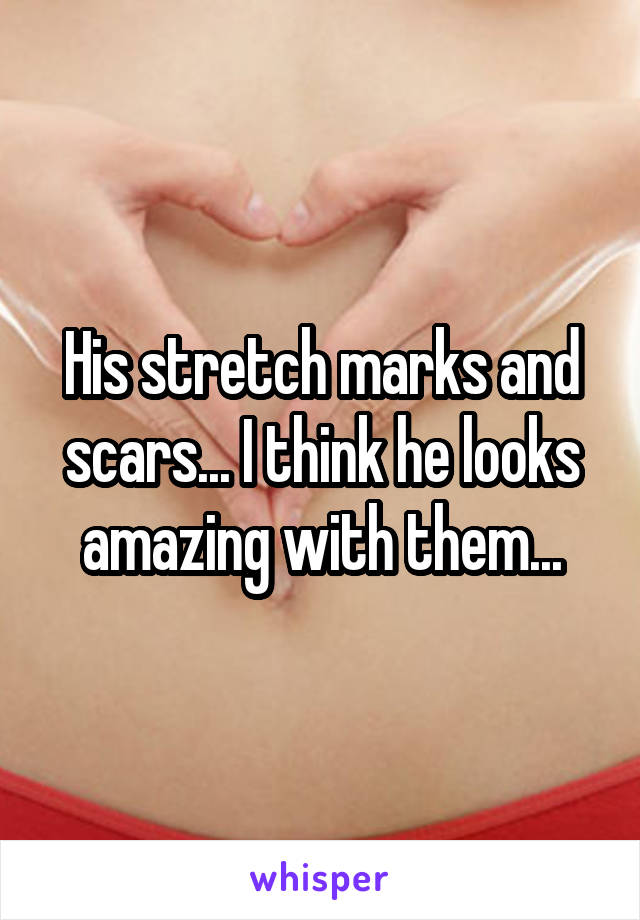 His stretch marks and scars... I think he looks amazing with them...
