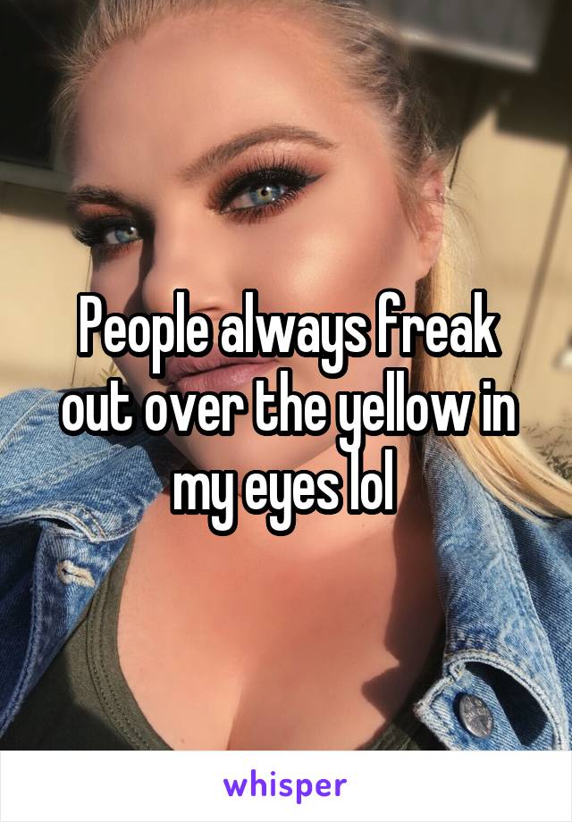 People always freak out over the yellow in my eyes lol 