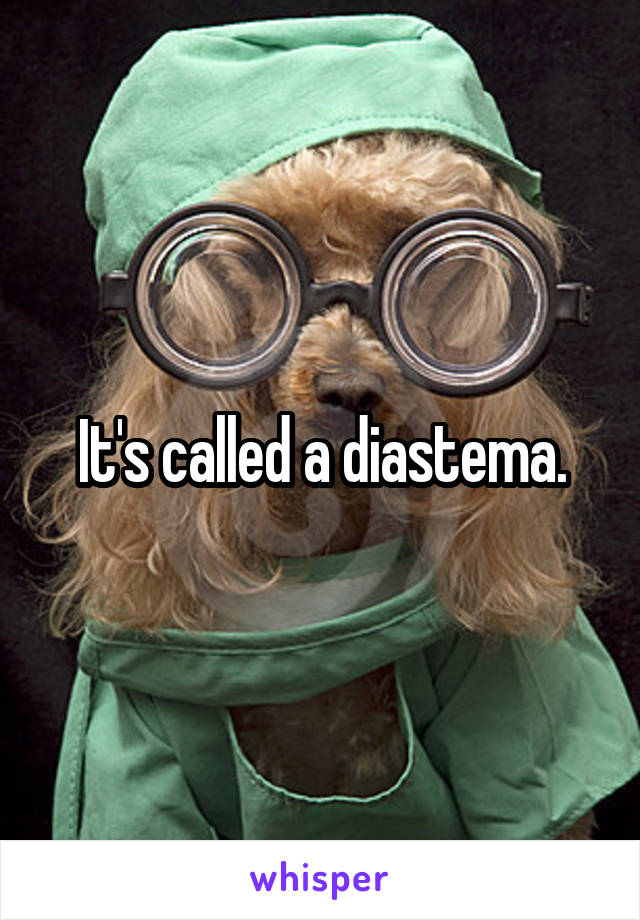 It's called a diastema.