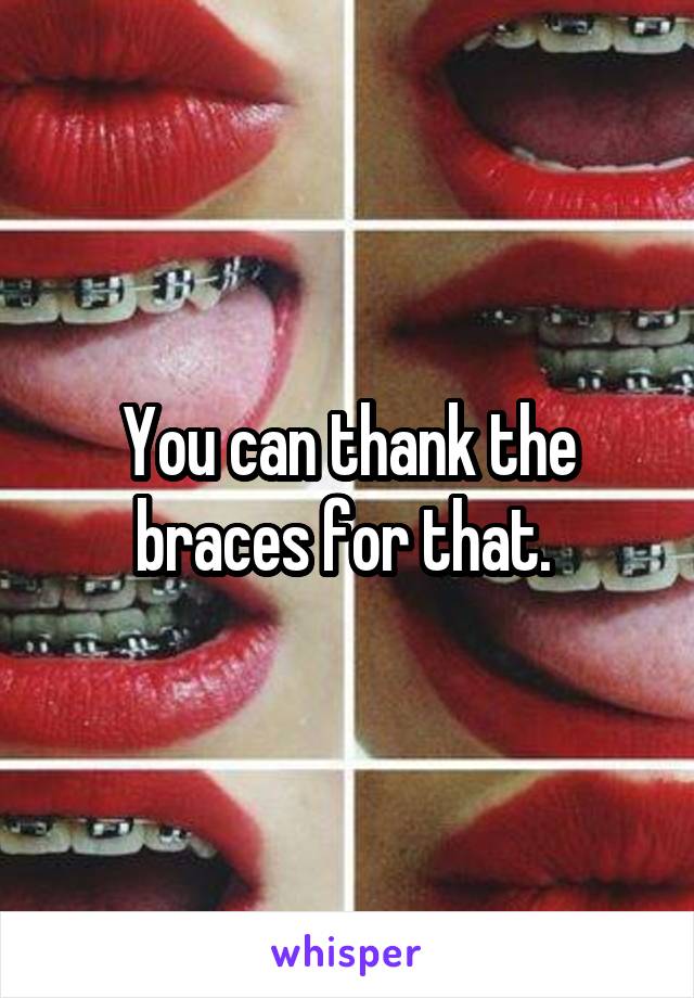 You can thank the braces for that. 