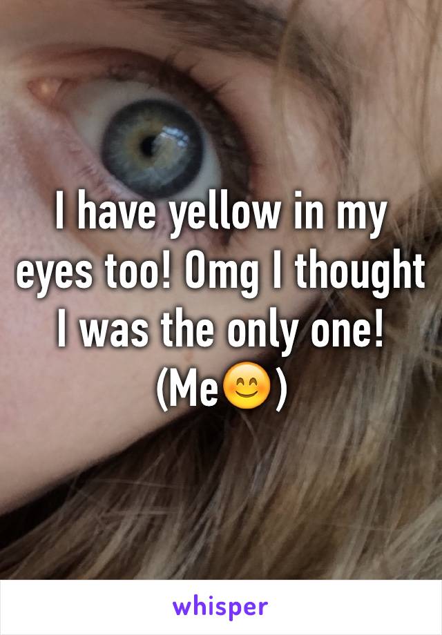 I have yellow in my eyes too! Omg I thought I was the only one!
(Me😊)