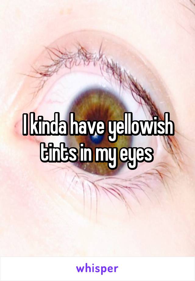 I kinda have yellowish tints in my eyes 