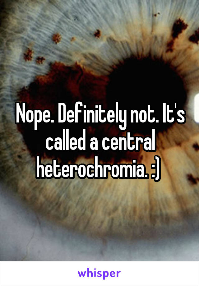 Nope. Definitely not. It's called a central heterochromia. :) 