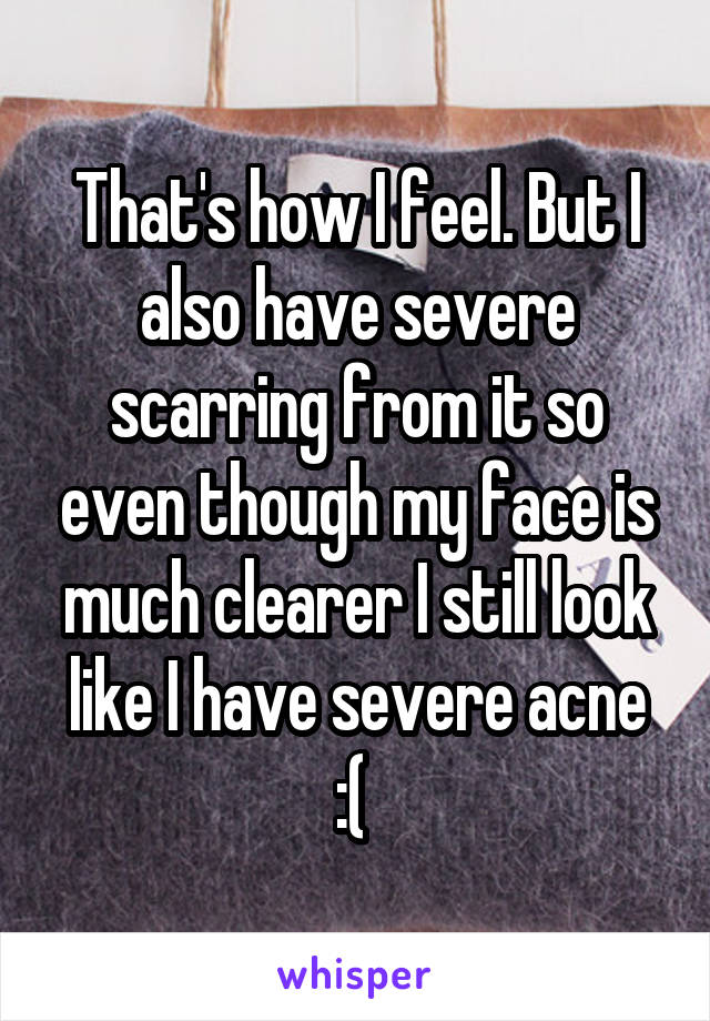 That's how I feel. But I also have severe scarring from it so even though my face is much clearer I still look like I have severe acne :( 